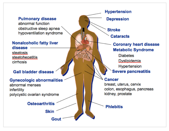 Obesity and Health | The Obesity Society